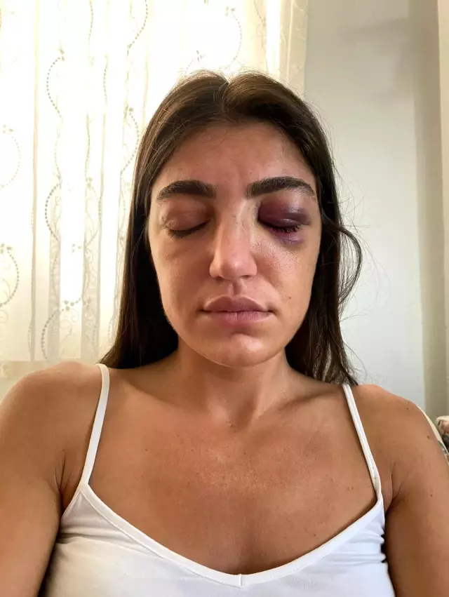 Ünlü mankene öldüresiye dayak kamerada