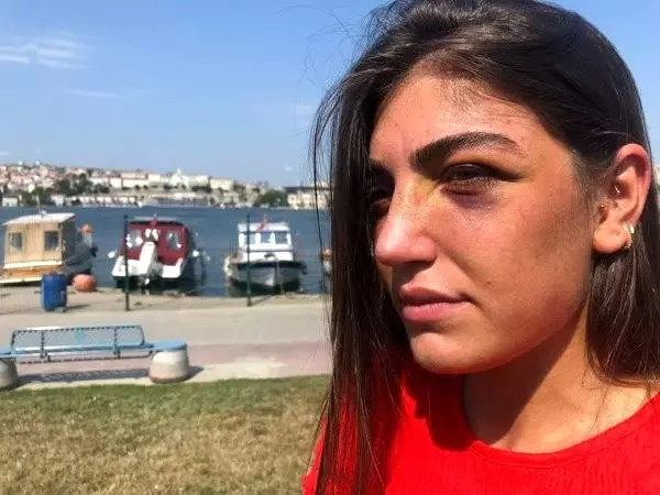 Ünlü mankene öldüresiye dayak kamerada