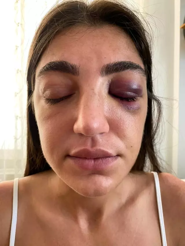 Ünlü mankene öldüresiye dayak kamerada