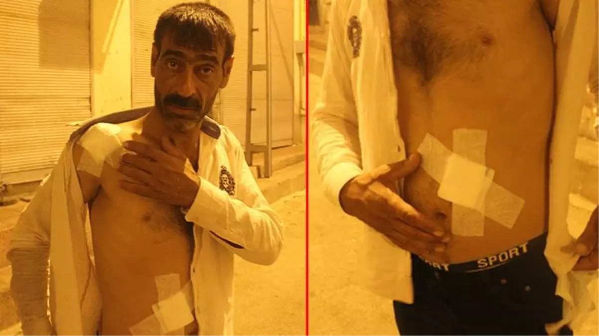 Damda çay keyfi kabusa dönüştü! Husumetli komşularının pompalı kavgasında saçmaların hedefi oldu