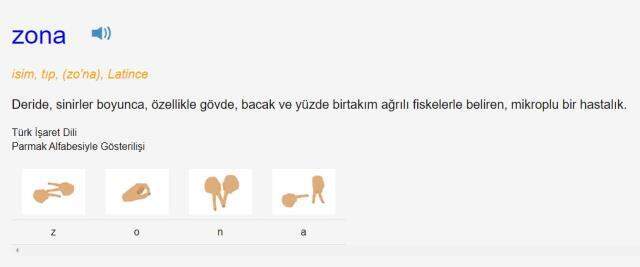 Zona bulaşıcı mı? Zona nedir, ne demek? Zona hastalığı bulaşıcı mıdır? Zona bulaşır mı? Zona belirtileri nelerdir? Zona bulaşıcı mı? Zona nedir, ne demek? Zona hastalığı bulaşıcı mıdır? Zona bulaşır mı? Zona belirtileri nelerdir?