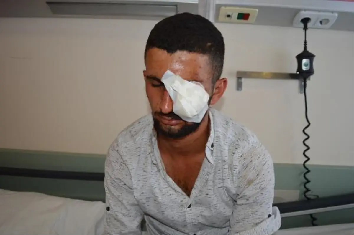 YERDE BULDUĞU HAVAİ FİŞEĞİN PATLAMASIYLA GÖZÜNDEN YARALANDI