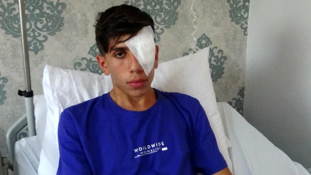 Diyarbakır'da rastgele atılan maytap, 17 yaşındaki genci sol gözünden etti