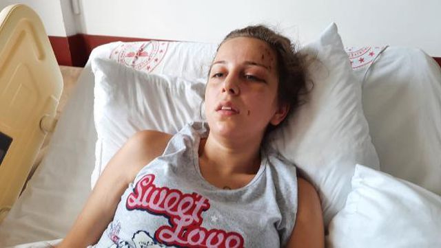 eski esinin 5 saat siddet uyguladigi kadin ki 2 14293679 o