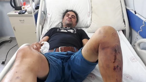 Kaza sonucu hastaneye kaldırılan adamı eli ve ayağından yatağa bağladılar