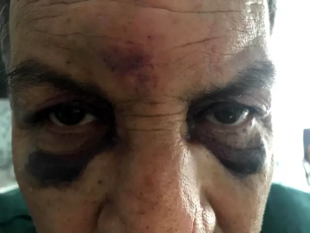 Son dakika haberi: Öldüresiye darp edilip hakkında dava açılan yaşlı adamın görüntüleri ortaya çıktı