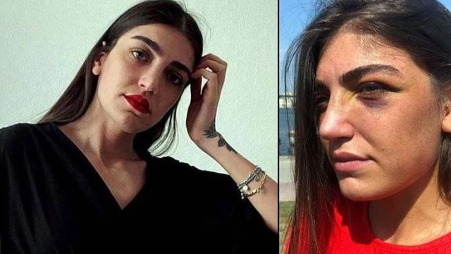 Manken Gizem Akbaş'ı öldüresiye döven eski sevgilisi sadece 9 gün tutuklu kaldı