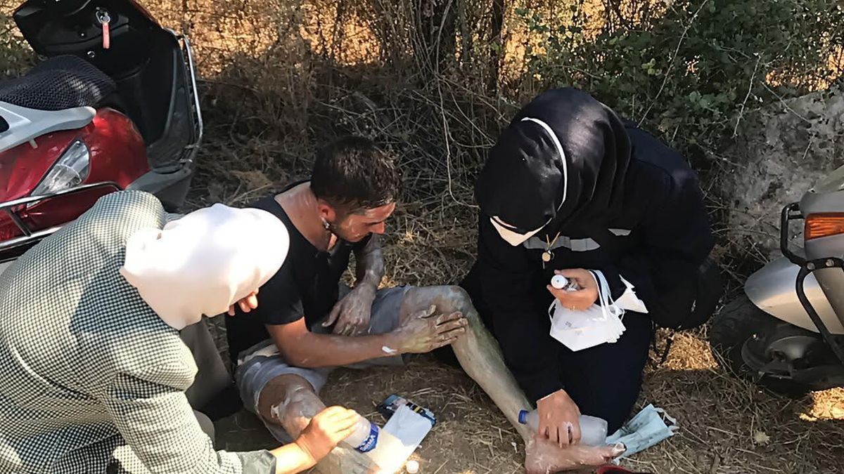 Muğla'da yangından vücudu yanan gence ilk müdahaleyi Malatya Milletvekili Çalık yaptı