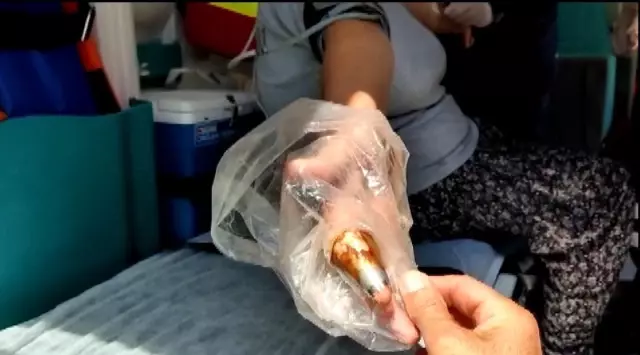 Isparta'da parmağı pasta aparatına sıkışan kadın, tırnak makasıyla kurtarıldı