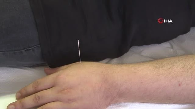 Fazla kilolara karşı en tesirli silah akupunktur