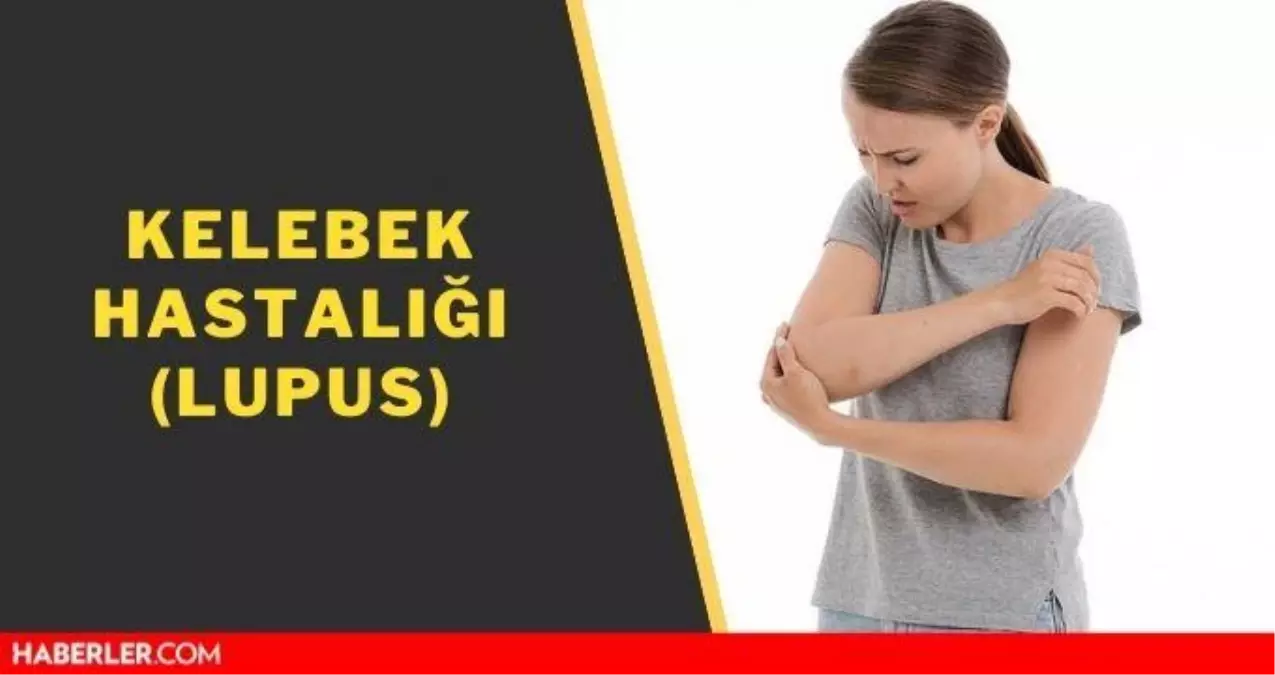 Kelebek hastalığı! Lupus (Kelebek hastalığı) nedir? SLE nedir, belirtileri nelerdir?