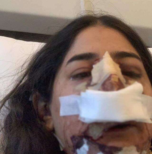 Burun estetiği yaptıran kadının hayatı karardı, pişkin doktor ise 'Düğün hediyem olsun' dedi Burun estetiği yaptıran kadının hayatı karardı, pişkin doktor ise 'Düğün hediyem olsun' dedi