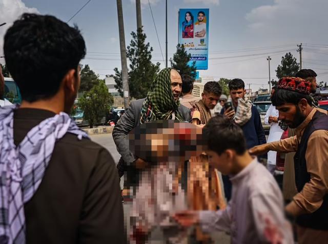 Bu imajlara yürek dayanmaz! Taliban zulmü çocukları da kanlar içinde bıraktı