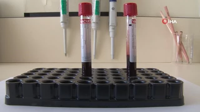 "Sabun bile yapamazlar" diyenlere inat antikor test kiti geliştirdiler