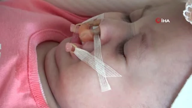 Çift taraflı dudak-damak yarığı ile doğan bebek sıhhatine kavuşacak
