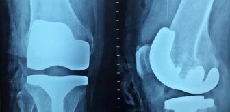 Ortopedi nedir? Ortopedi neye bakar?