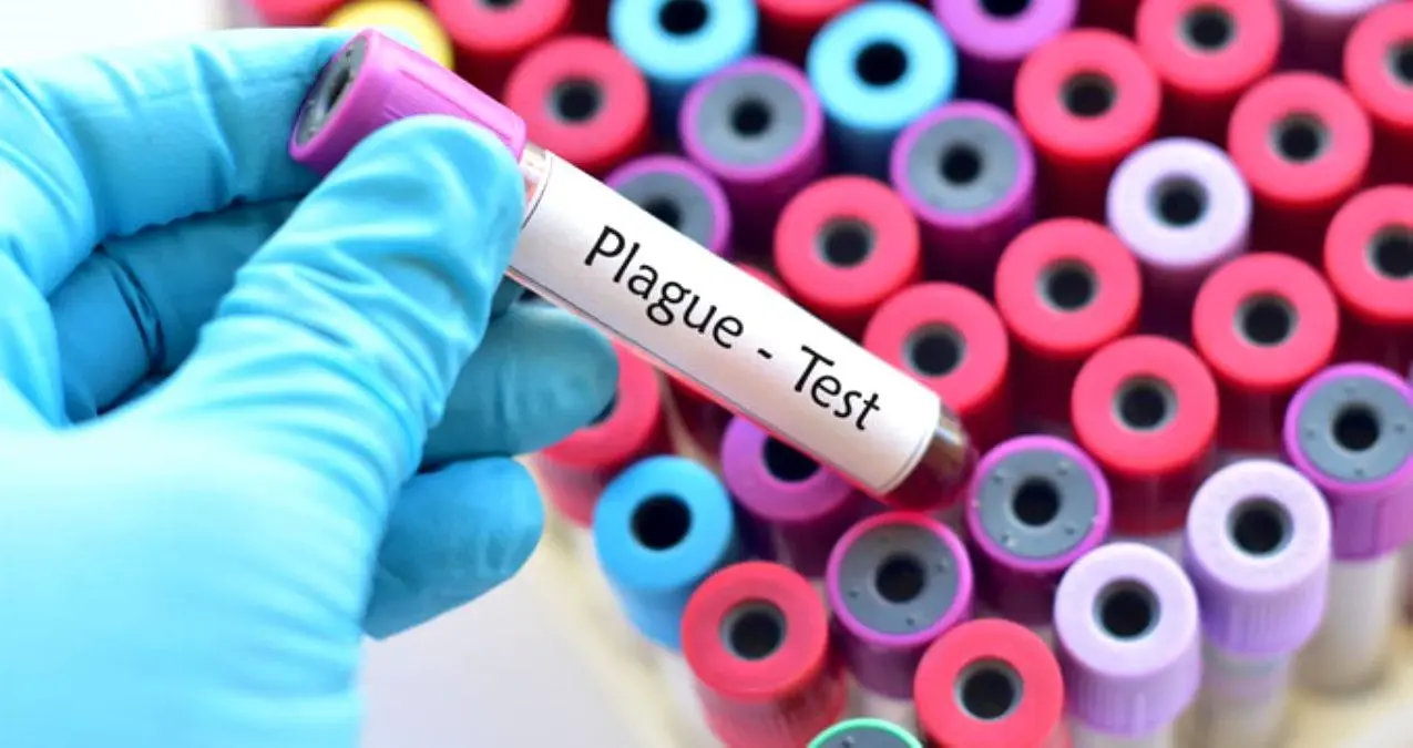Veba nedir? Veba hastalığı belirtileri, teşhisi ve tedavisi nasıl olmalıdır?