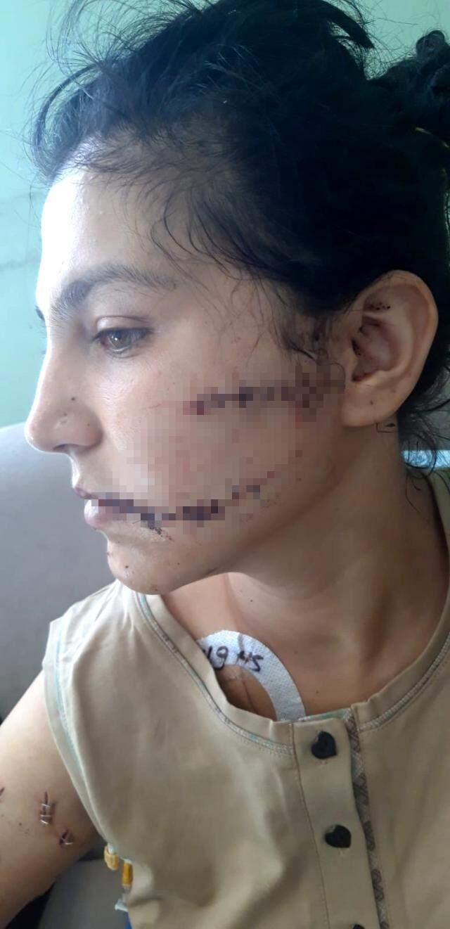 Eşinin banyoya kilitleyip 100 yerinden bıçakladığı kadın korku dolu anları anlattı Eşinin banyoya kilitleyip 100 yerinden bıçakladığı kadın korku dolu anları anlattı