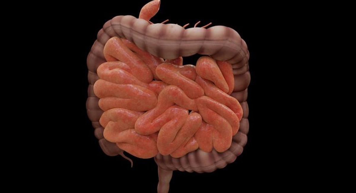 Crohn hastalığı nedir? Crohn hastalığı belirtileri, crohn hastalarının beslenmeleri, crohn hastalarının tedavisi nedir?