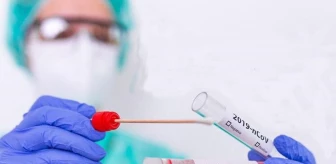 Aşısızlar, PCR test laboratuvarlarının yükünü artırıyor