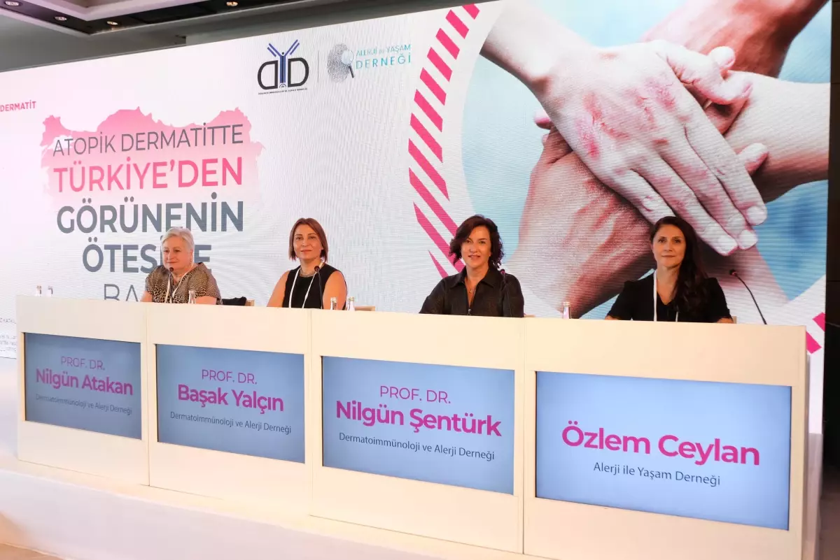 Türkiye'de ilk kez yapılan 'atopik dermatit' araştırmasının sonuçları paylaşıldı