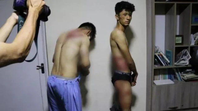 Taliban'dan Afgan gazetecilere 4 saat süren işkence! Bedenlerindeki morlukları kameralara gösterdiler