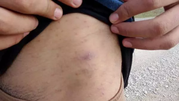 Yunan güvenlik güçleri, dövüp elektrik verdikleri göçmenleri Türkiye'ye geri itti
