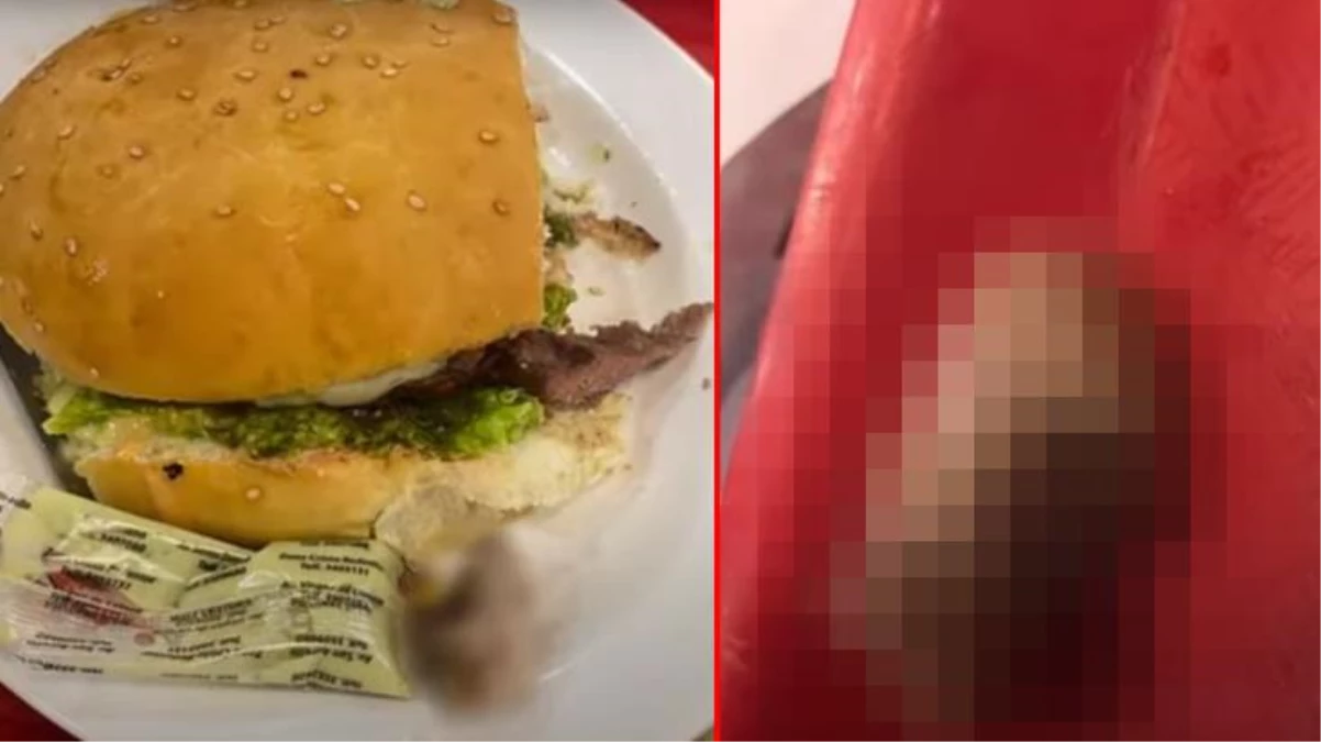 Bolivya'da bir kadının yediği hamburgerden insan parmağı çıktı