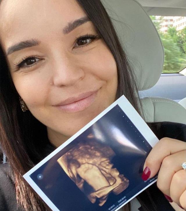 7 aylık hamile Bengü, bebeğinin ultrason görüntülerini takipçileriyle paylaştı