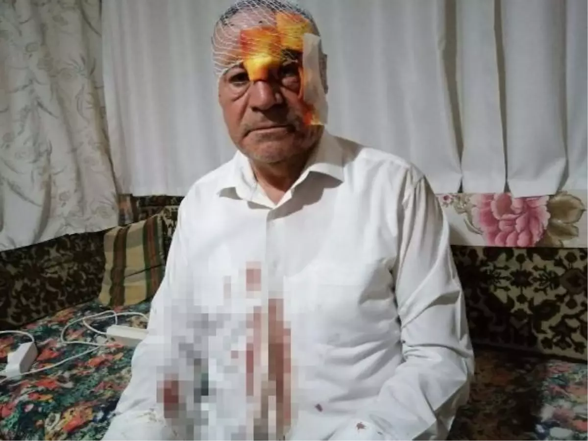 Minibüsçü ilçe başkanına sopalı saldırı