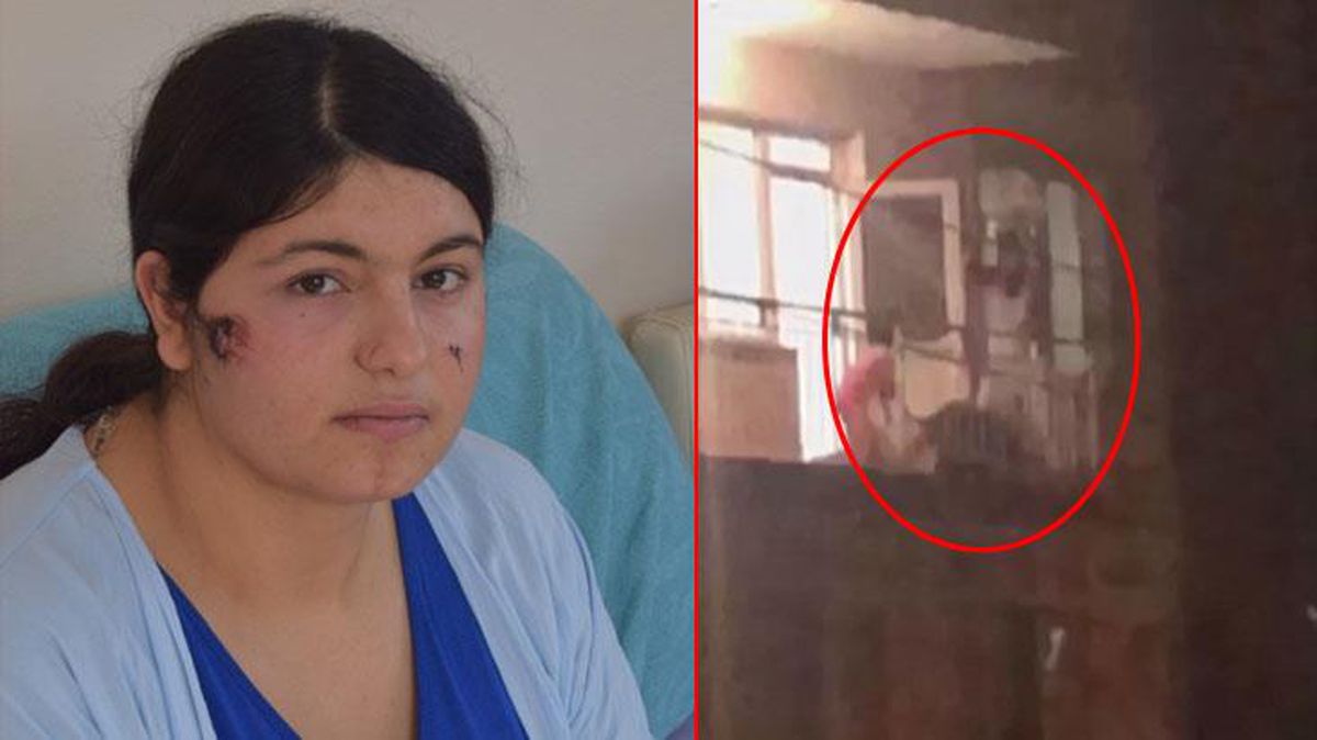 Uyuşturucu bağımlısı eşi, tabureyle öldüresiye dövdü! Çocukları için şiddete sessiz kalan kadının tek bir isteği var