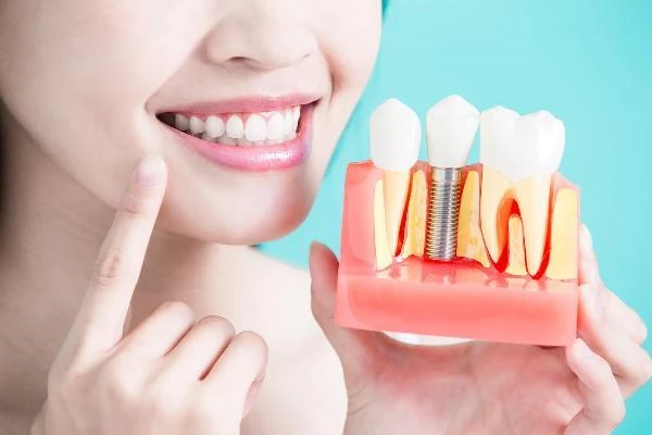 "Diş kaybı sıkıntılarında implant tedavisi en çok tercih edilen tahliller arasında"