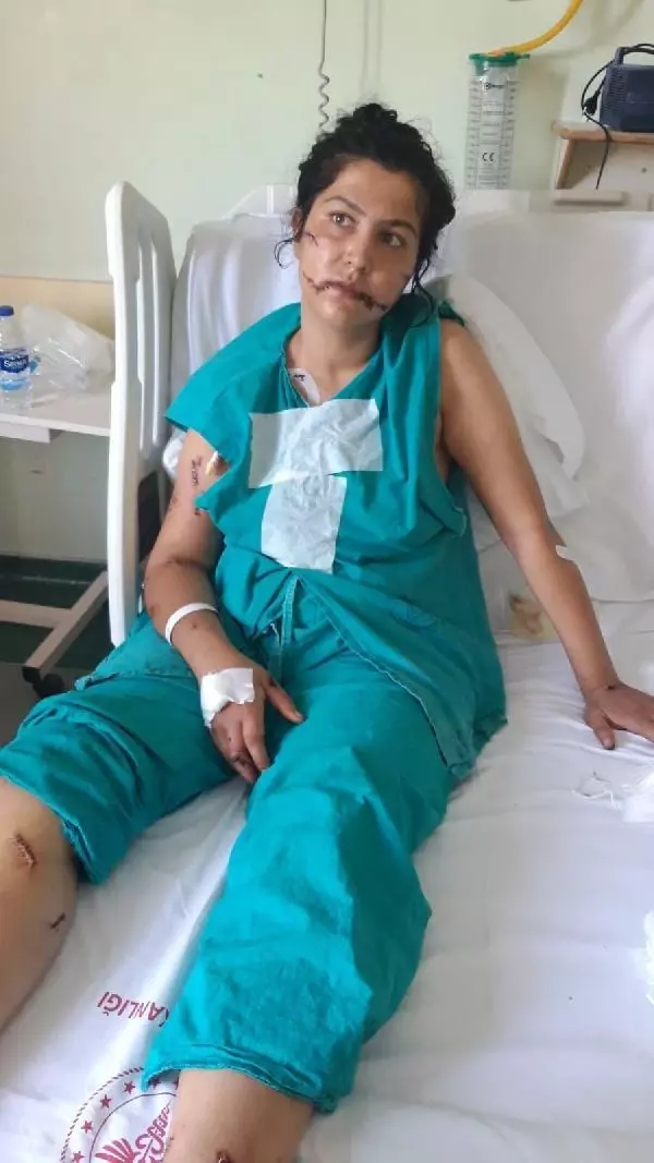 104 yerinden bıçakladığı çocuğunun annesi can çekişirken başında sigara içmiş