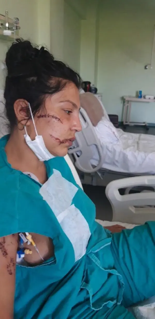 104 yerinden bıçakladığı çocuğunun annesi can çekişirken başında sigara içmiş