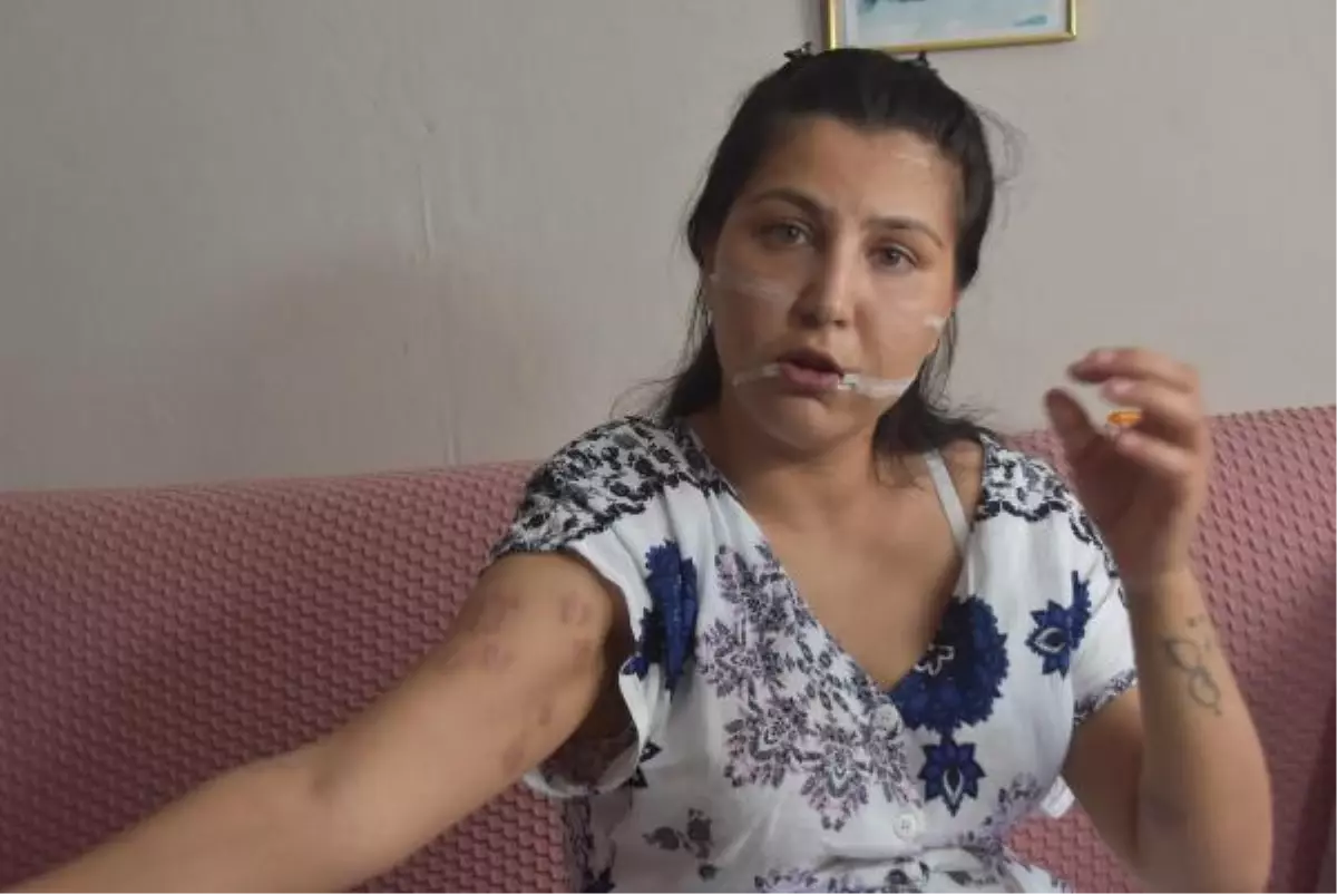 104 yerinden bıçakladığı çocuğunun annesi can çekişirken başında sigara içmiş