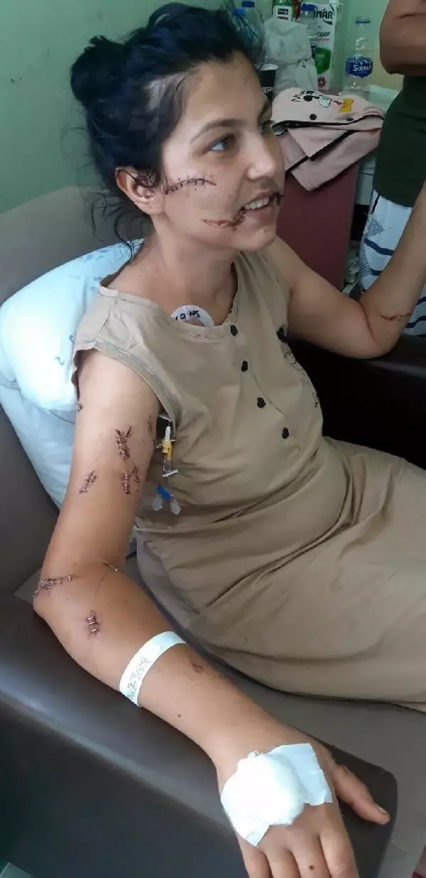104 yerinden bıçakladığı çocuğunun annesi can çekişirken başında sigara içmiş