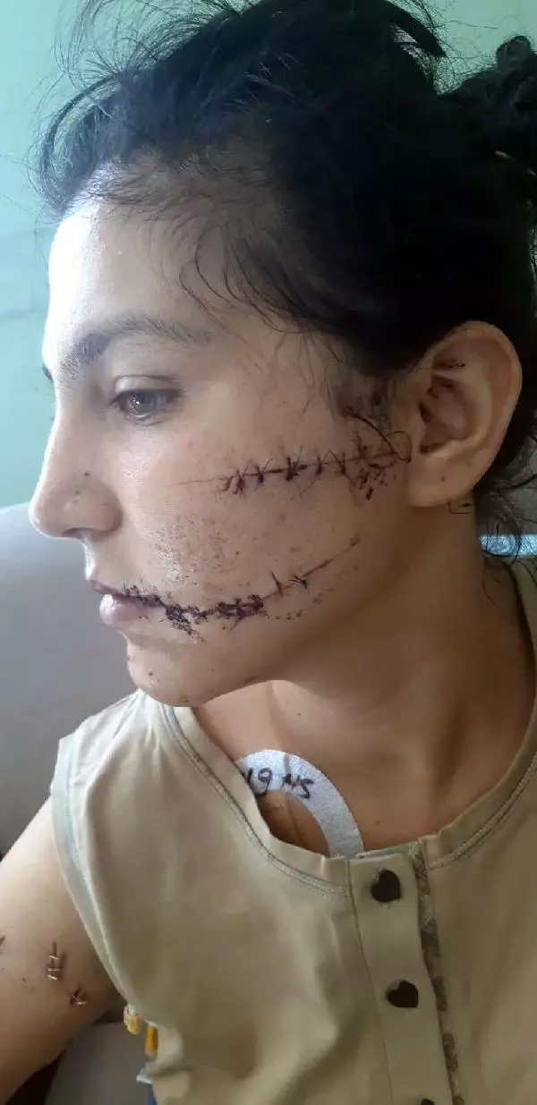 104 yerinden bıçakladığı çocuğunun annesi can çekişirken başında sigara içmiş