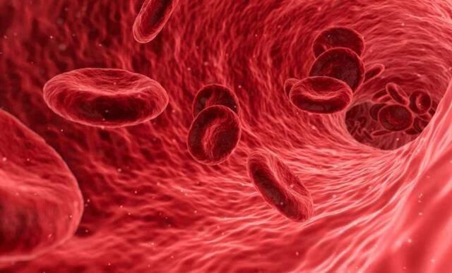 MCV nedir? MCV kaç olmalıdır? MCV yüksekliği, MCV düşüklüğü ne demektir? Nasıl tedavi edilir? MCV nedir? MCV kaç olmalıdır? MCV yüksekliği, MCV düşüklüğü ne demektir? Nasıl tedavi edilir?