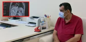 Karnından basket topu büyüklüğünde tümör çıkarıldı