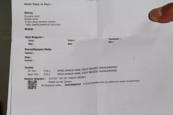 GÜZELLİK MERKEZİNDE LAZER İŞLEMİ YAPTIRDI, KOLLARI VE BACAĞI YANDI