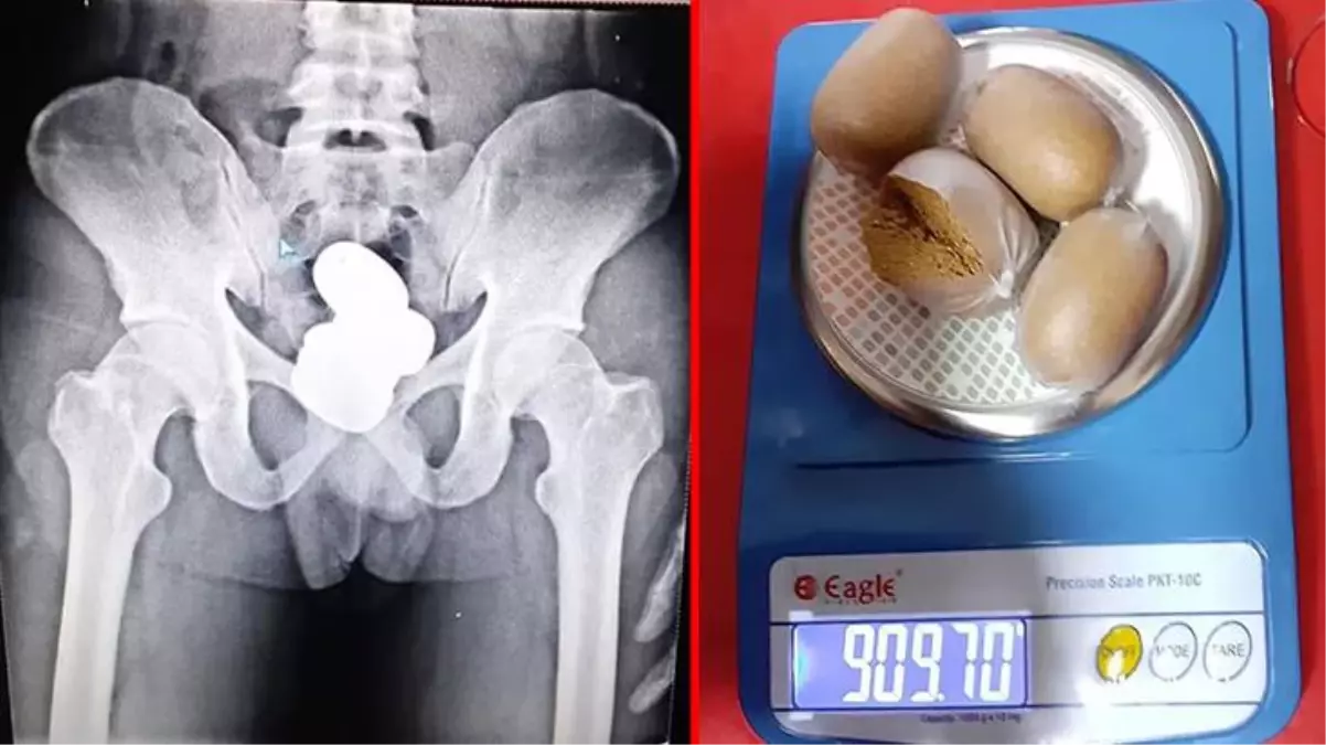 Havalimanında yakalanan kaçakçının makatından 4 kapsül halinde 1 kiloya yakın altın çıktı