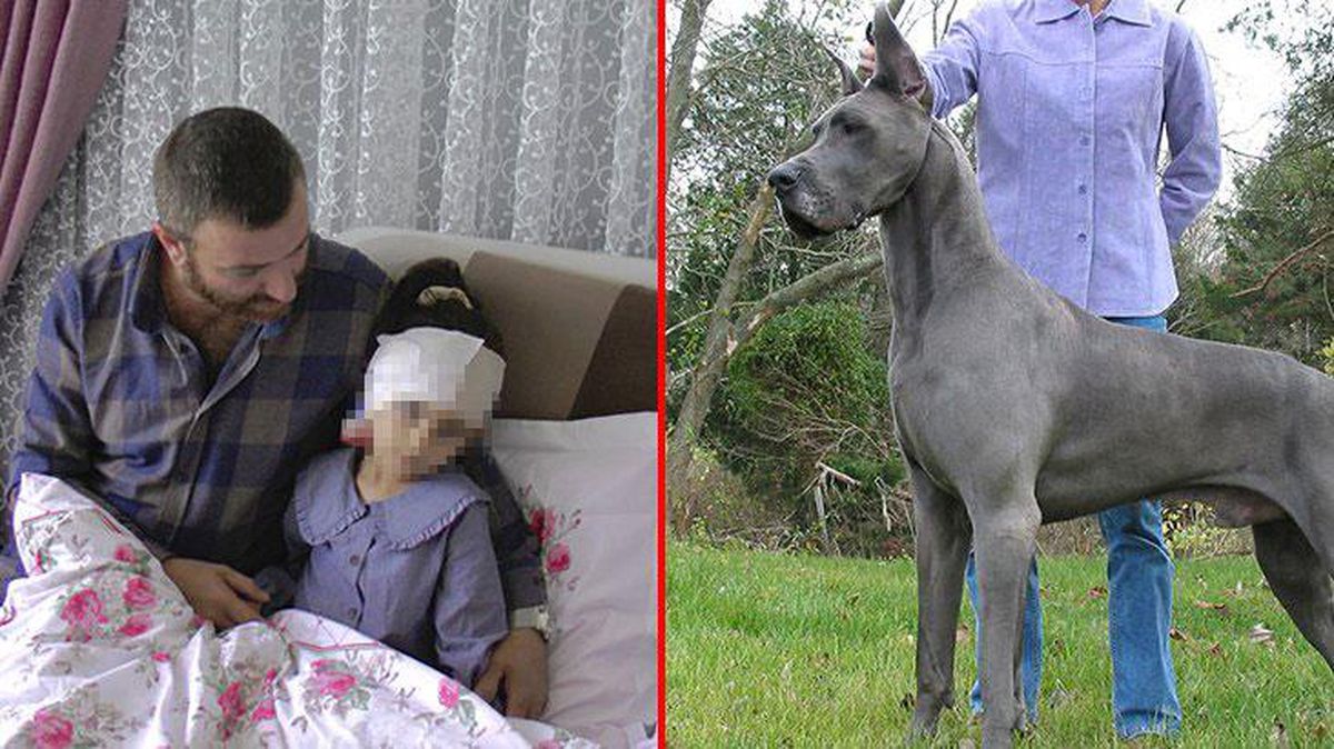 Korku filmi gibi! Bir anda üzerine koşan köpeğin saldırısına uğrayan kızın kulağı koptu