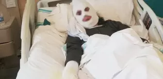 Gazı çakmakla kontrol eden yaşlı kadın feci şekilde yaralandı