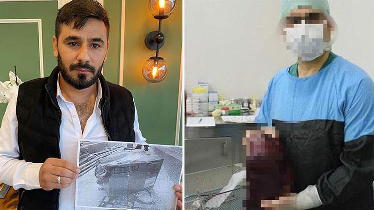 Kayıp dalak soruşturmasında özel hastaneye 3 bin lira idari para cezası kesildi