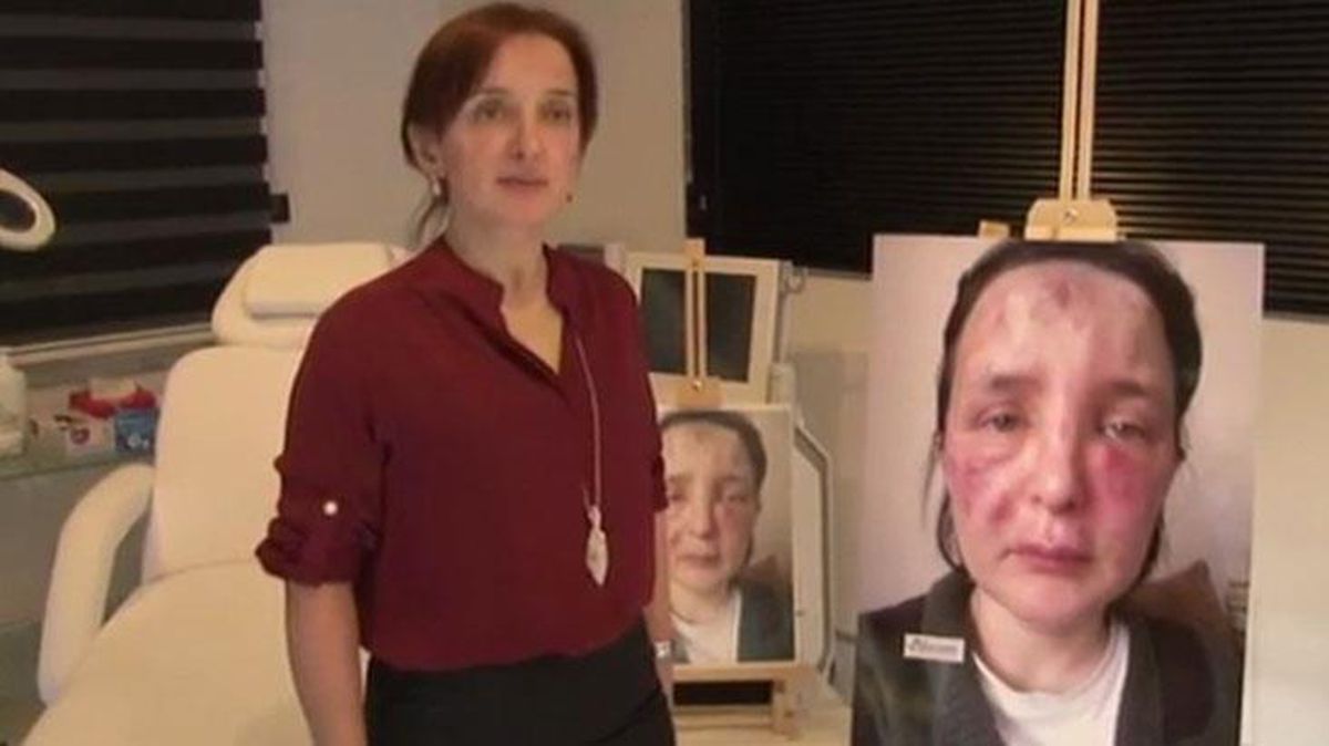 Estetik yaptığı kadının yüzünü tanınmaz hale getiren sahte doktora ceza yağdı