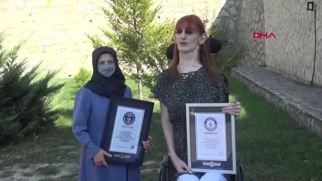 DÜNYANIN EN UZUN KADINI RUMEYSA: FARKLI OLMAK KÖTÜ BİR ŞEY DEĞİL