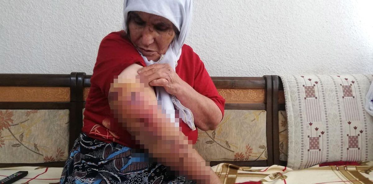 Köpeğin saldırısına uğrayan kadın ölümden döndü