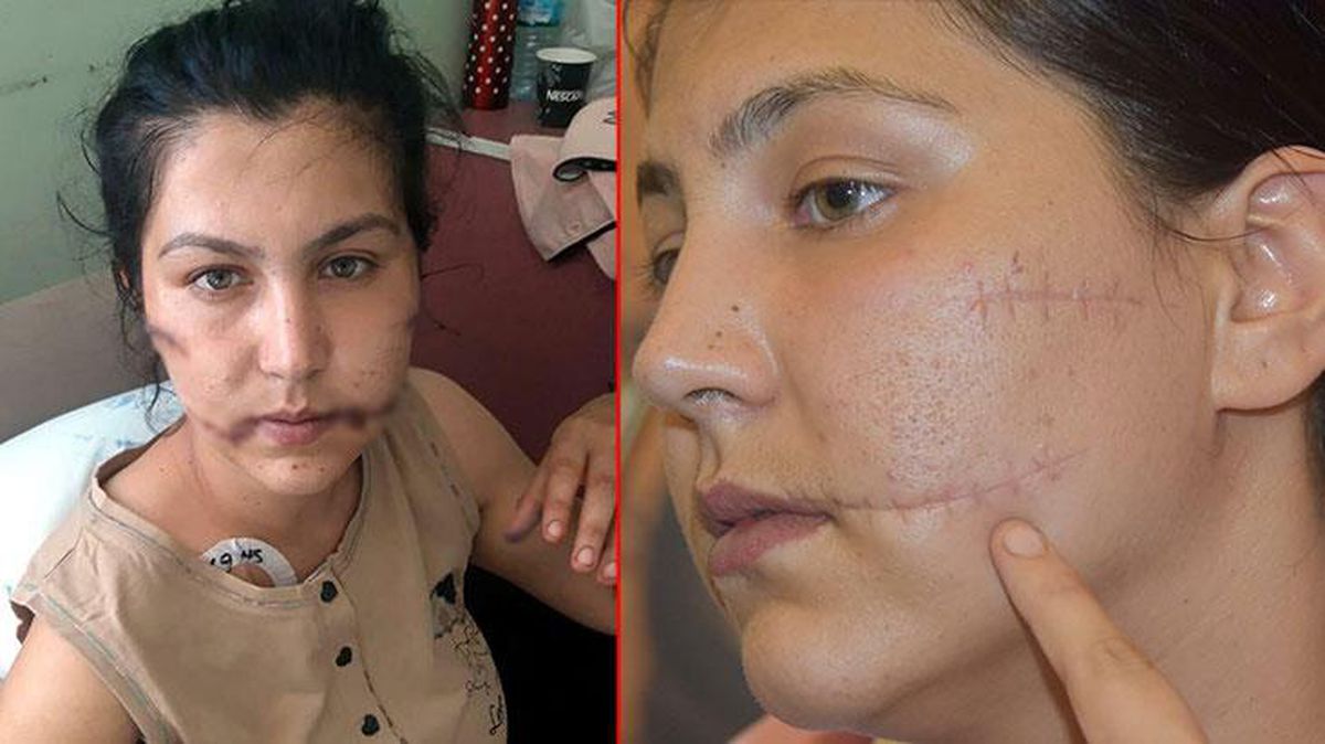 104 yerinden bıçakladığı Aysel'in başında ölmesini bekledi! Cani kocanın 20 yıla kadar hapsi isteniyor