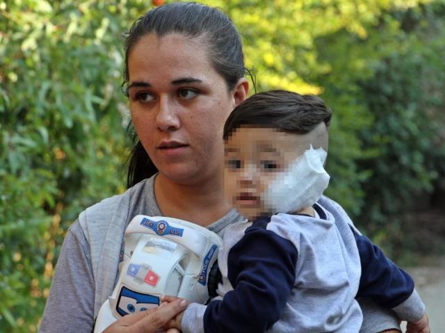 Pitbull, baba ve 11 aylık oğlunu hastanelik etti! Küçük Sadrettin'in yanağı ve kulağı koptu