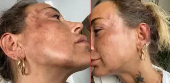 Mekandan zorla çıkardığı eski sevgilisini araçta taciz edip, darbetti! Genç kadın, kırmızı ışıkta kaçıp canını kurtardı